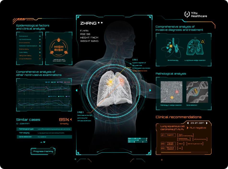 care.aiTM肺癌多學科智能診斷系統